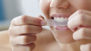 teeth whitening strips teeth whitening strips